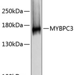 MYBPC3 Rabbit pAb