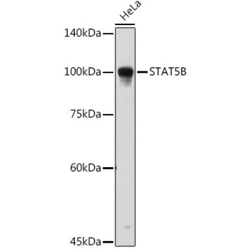 STAT5B Rabbit pAb