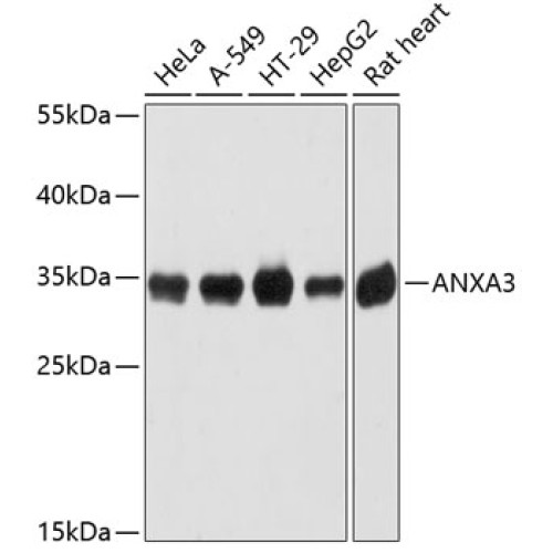 ANXA3 Rabbit pAb