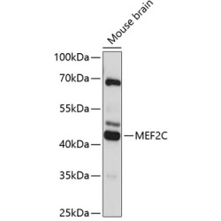 MEF2C Rabbit pAb