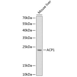 ACP1 Rabbit pAb
