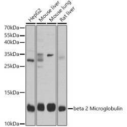 beta 2 Microglobulin Rabbit pAb