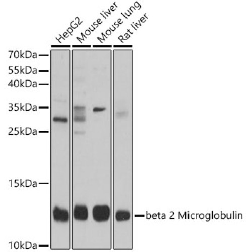 beta 2 Microglobulin Rabbit pAb