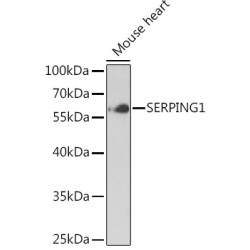 SERPING1 Rabbit pAb