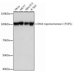 DNA topoisomerase I (TOP1) Rabbit mAb