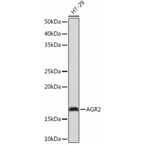 AGR2 Rabbit mAb