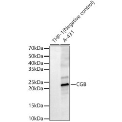 CGB Rabbit pAb