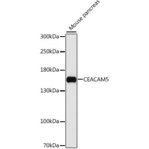 CEACAM5 Rabbit pAb