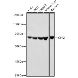 CPT2 Rabbit pAb