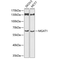 MGAT1 Rabbit pAb