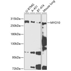 MYO10 Rabbit pAb