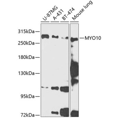 MYO10 Rabbit pAb