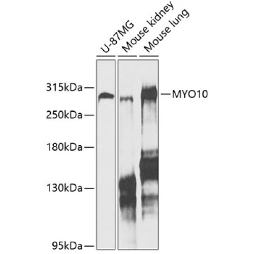 MYO10 Rabbit pAb