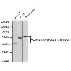 Alpha-1 Antitrypsin (SERPINA1) Rabbit pAb