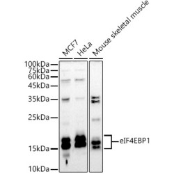 eIF4EBP1 Rabbit pAb
