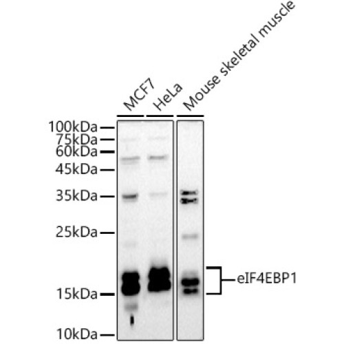 eIF4EBP1 Rabbit pAb