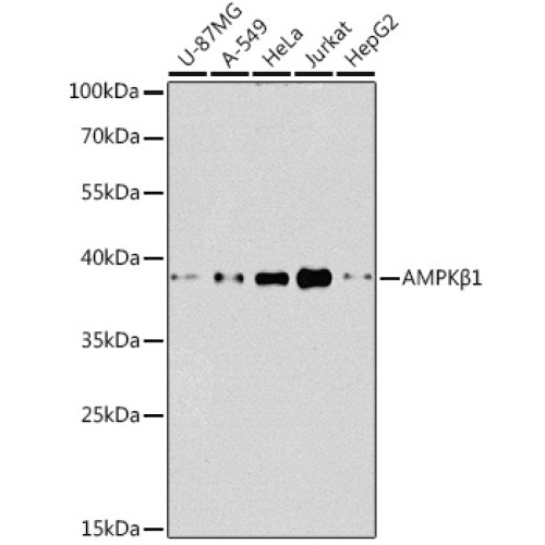 [KO Validated] AMPKβ1 Rabbit pAb