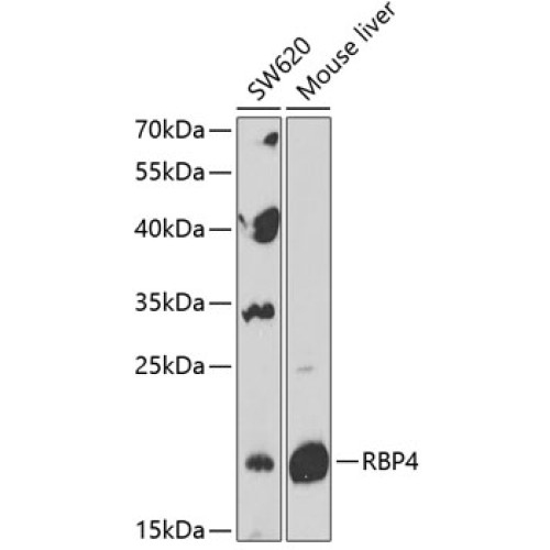 RBP4 Rabbit pAb