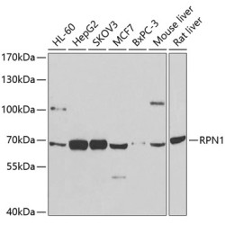 RPN1 Rabbit pAb