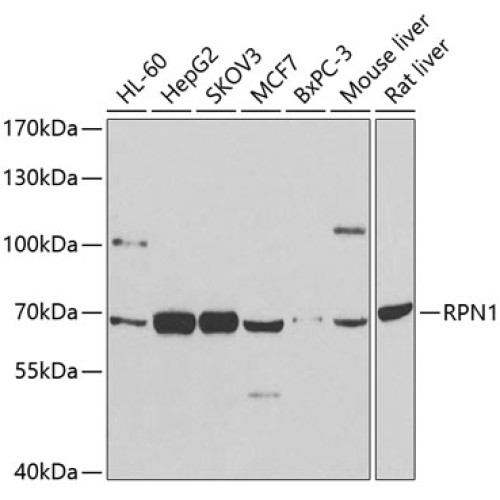RPN1 Rabbit pAb