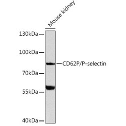 CD62P/P-selectin Rabbit pAb