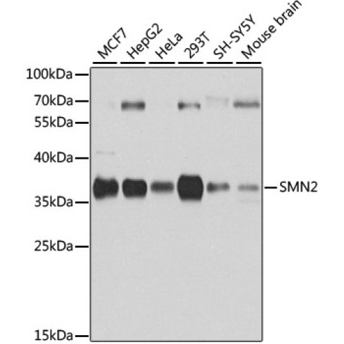 SMN2 Rabbit pAb