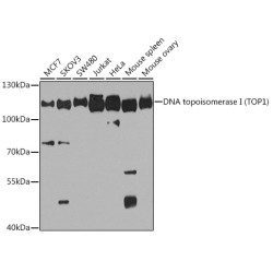 DNA topoisomerase I (TOP1) Rabbit pAb