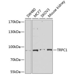 TRPC1 Rabbit pAb