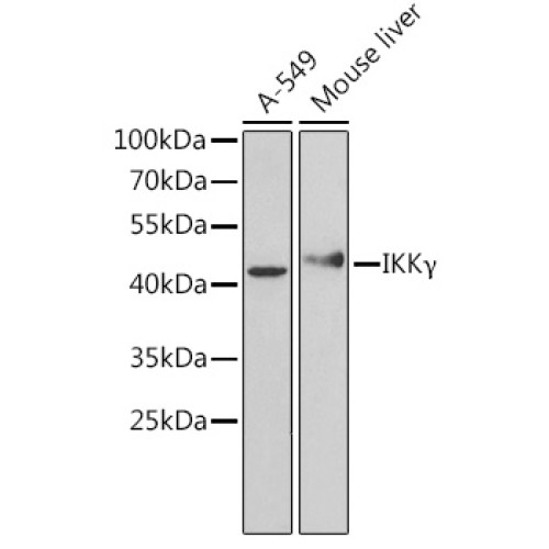 [KO Validated] IKKγ Rabbit pAb