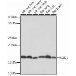 [KD Validated] SOD1 Rabbit mAb