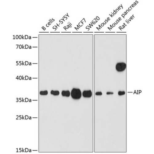 AIP Rabbit pAb