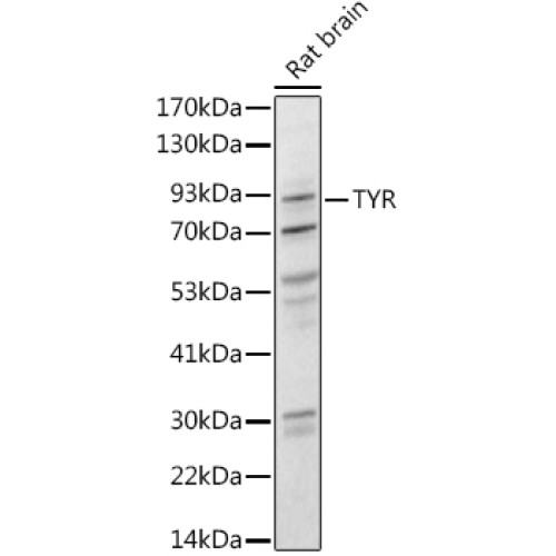 Tyrosinase Rabbit pAb