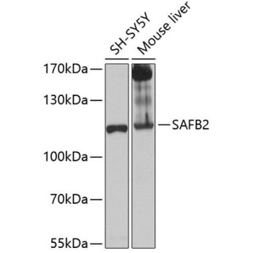 SAFB2 Rabbit pAb