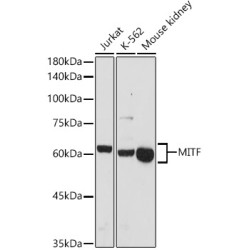 MITF Rabbit pAb