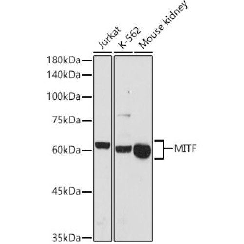 MITF Rabbit pAb