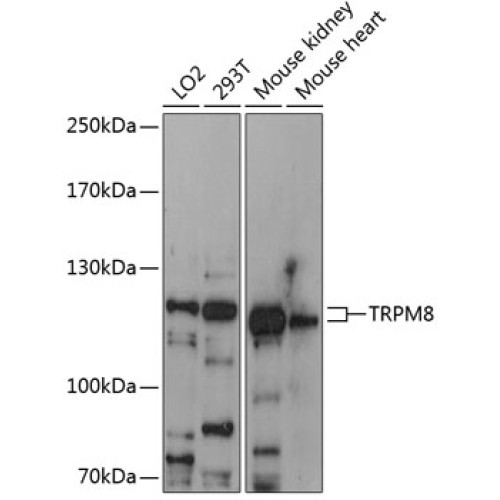 TRPM8 Rabbit pAb