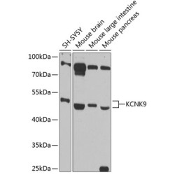 KCNK9 Rabbit pAb