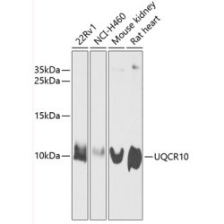 UQCR10 Rabbit pAb