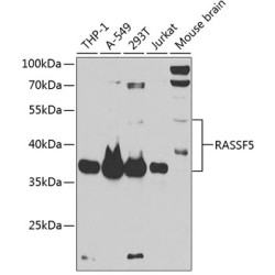 RASSF5 Rabbit pAb