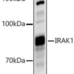 IRAK1 Rabbit pAb