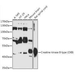 Creatine kinase B type (CKB) Rabbit pAb