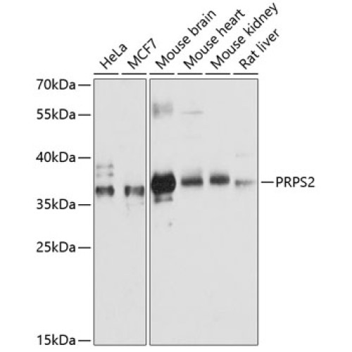 PRPS2 Rabbit pAb