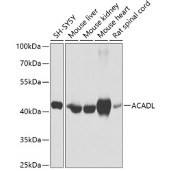 ACADL Rabbit pAb