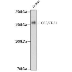 CR2/CD21 Rabbit mAb