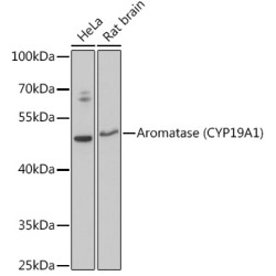 Aromatase (CYP19A1) Rabbit pAb
