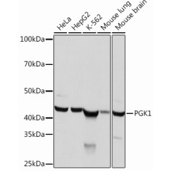 PGK1 Rabbit mAb