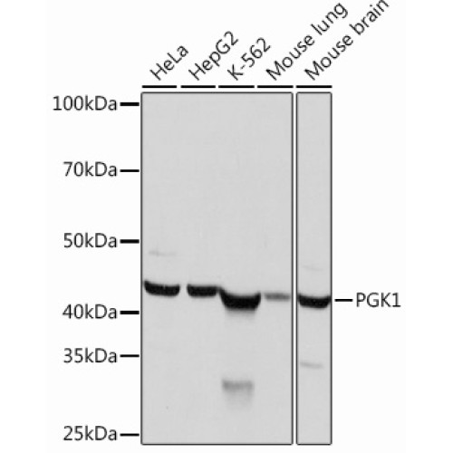 PGK1 Rabbit mAb
