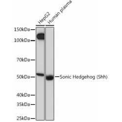 Sonic Hedgehog (Shh) Rabbit mAb