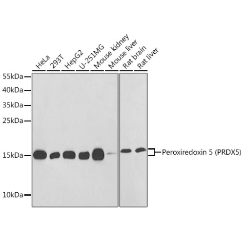 Peroxiredoxin 5 (PRDX5) Rabbit pAb