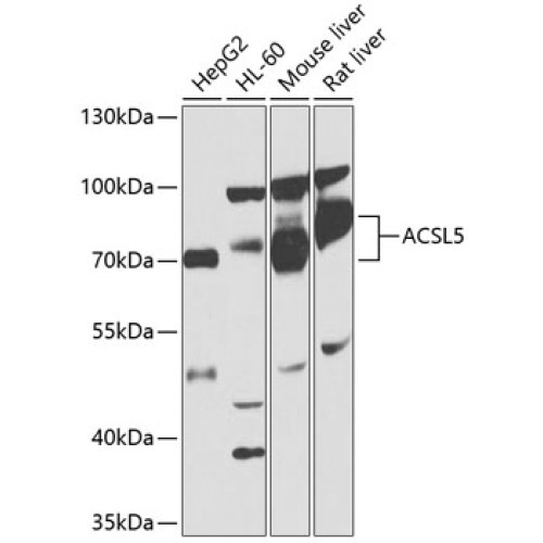 ACSL5 Rabbit pAb
